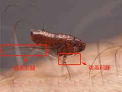 狗身上的跳蚤怎么去 